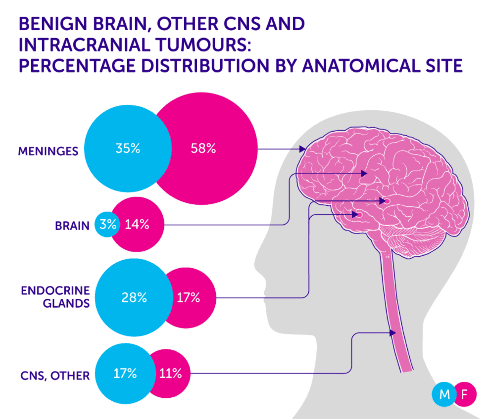 brain tumour location