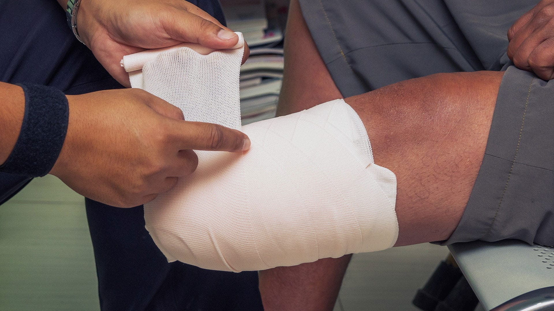 Amputation Negligence Compensation Claims