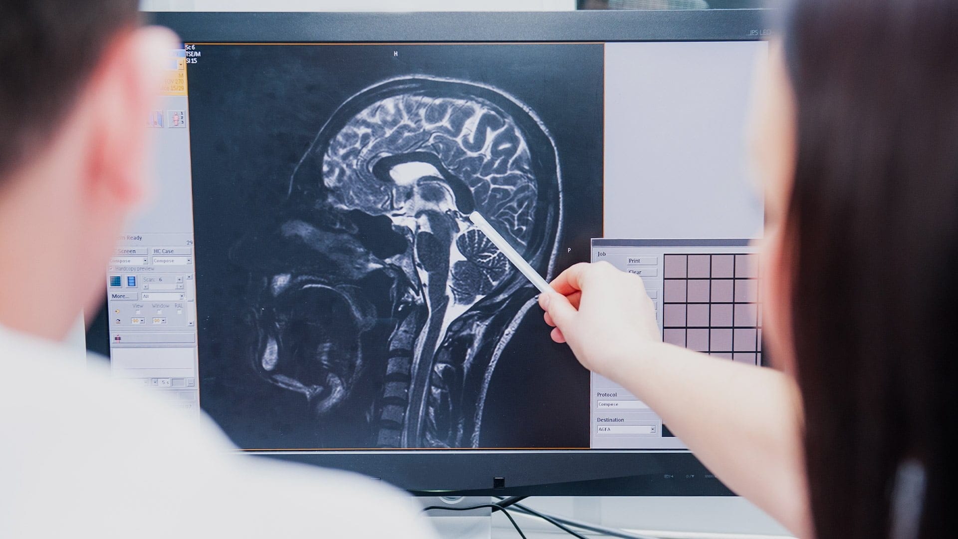 Brain Injury Compensation Claims