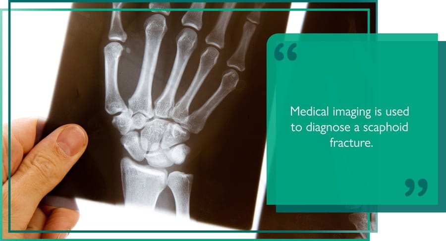 Anatomical illustration of hand and wrist bones