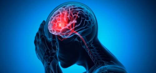 Brain Injury Claims