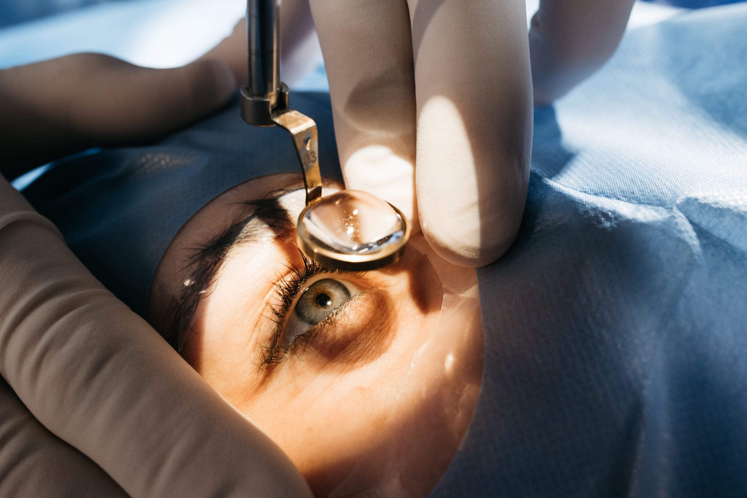 Surgery Image